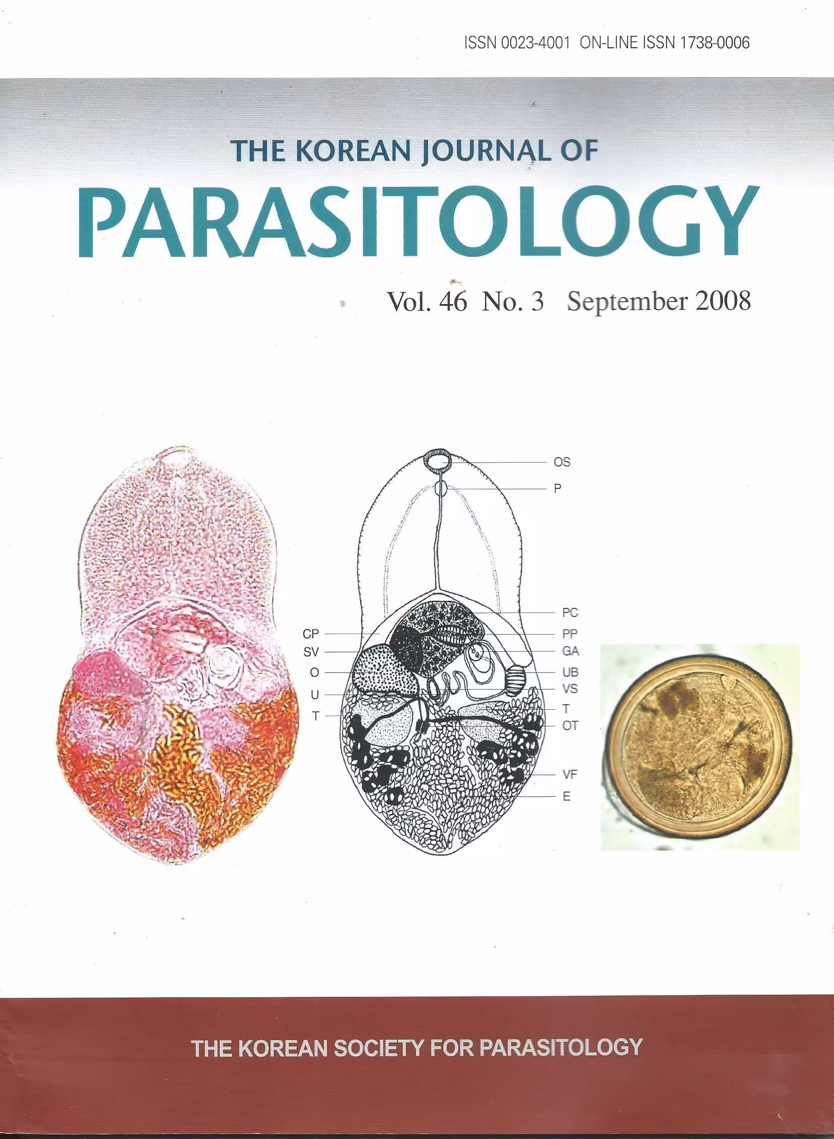 The Korean Journal of Parasitology, Vol. 46 No.3 September 2008