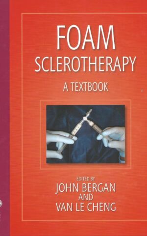 Foam Sclerotherapy, A Textbook